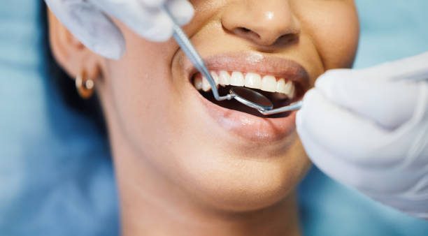 Best Emergency Dental Care for Abscessed Tooth in Golden Beach, MD